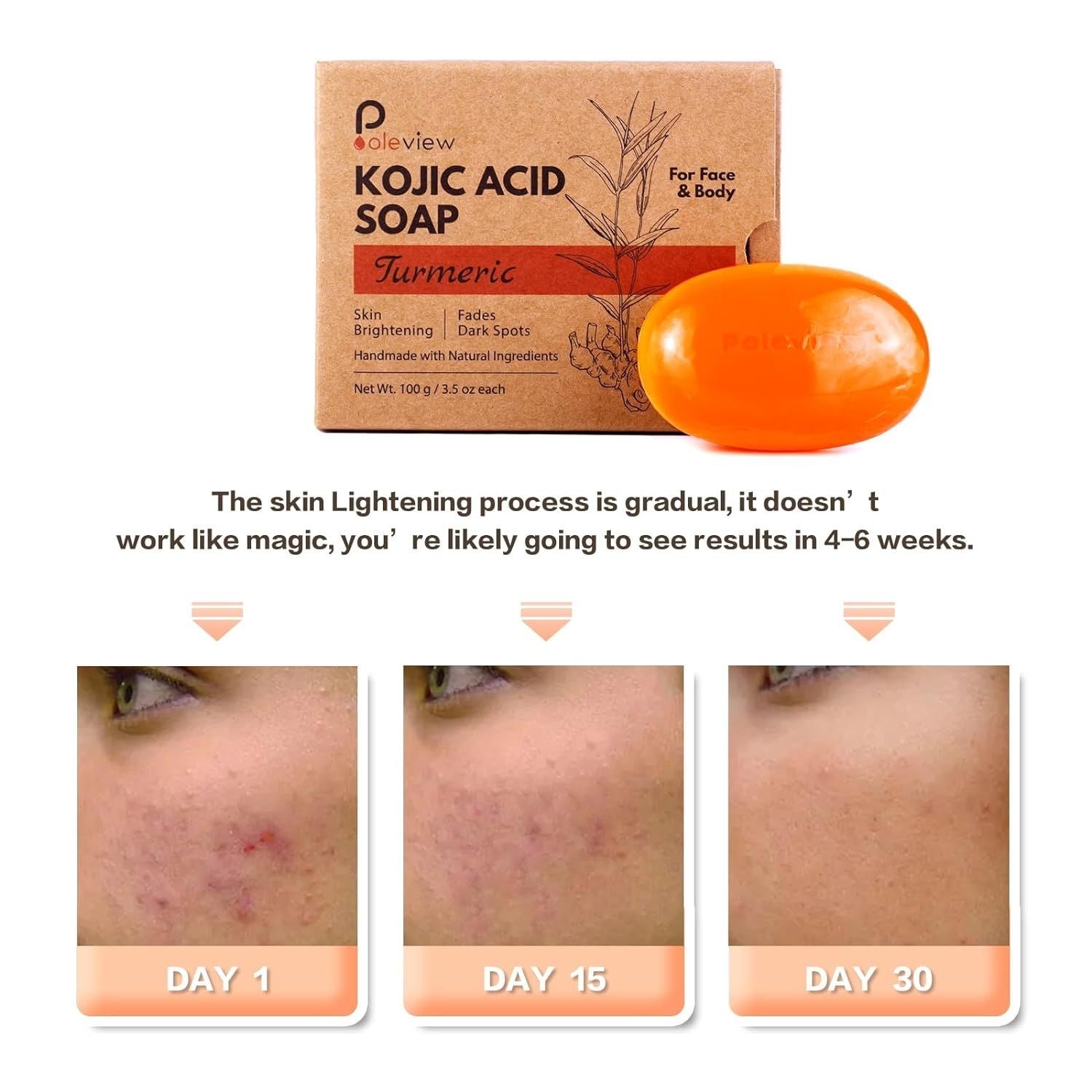 Southeast Asian ginger kojic acid soap, handmade soap, gentle cleansing facial soap, oil control, moisturizing, skin care, mite removal, and cold-dispelling, imported.